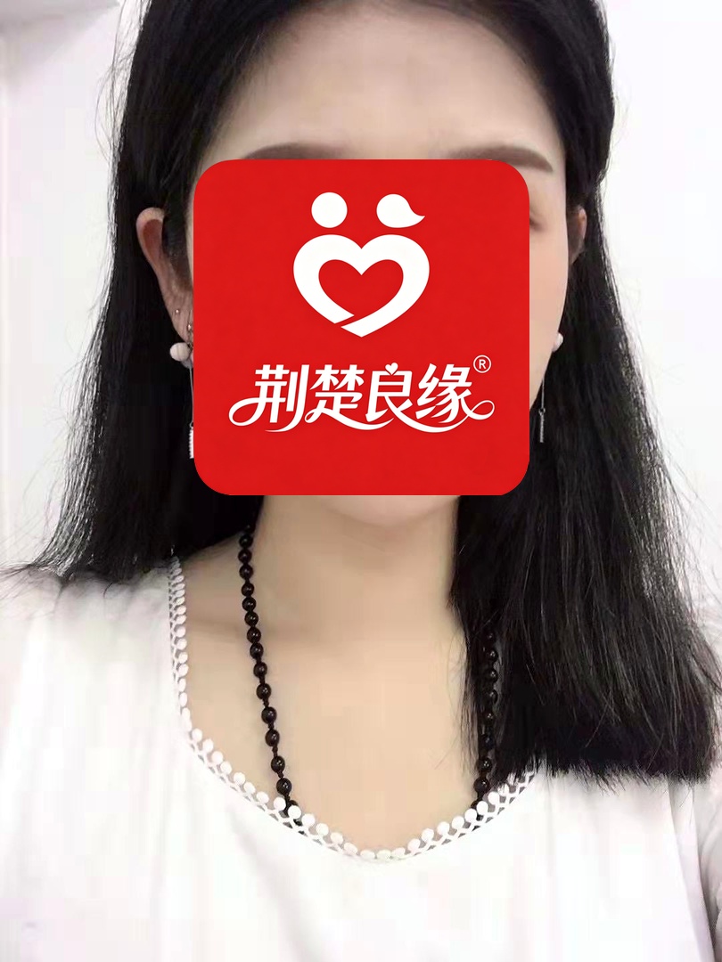 周琳本地真诚的照片